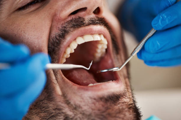Best Mobile Emergency Dentist in Mcelhattan, PA