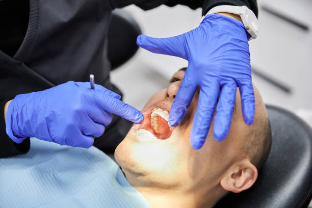 Best Emergency Dental Care for Abscessed Tooth in Mcelhattan, PA